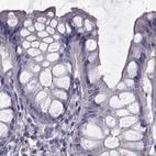 Immunohistochemical staining of human colon using Anti-FAM71B antibody HPA040771.