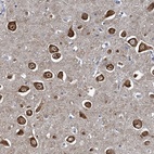 Anti-NCKAP1L Antibody
