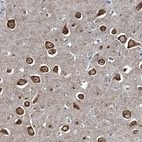 Anti-NCKAP1L Antibody