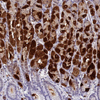 Immunohistochemical staining of human stomach shows strong cytoplasmic positivity in Parietal cells.