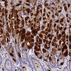 Immunohistochemical staining of human stomach shows strong cytoplasmic positivity in Parietal cells.