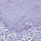 Immunohistochemical staining of human skin shows no positivity in squamous epithelial cells as expected.