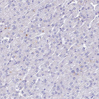 Immunohistochemical staining of human liver shows no positivity in hepatocytes as expected.