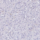 Immunohistochemical staining of human liver shows no positivity in hepatocytes as expected.