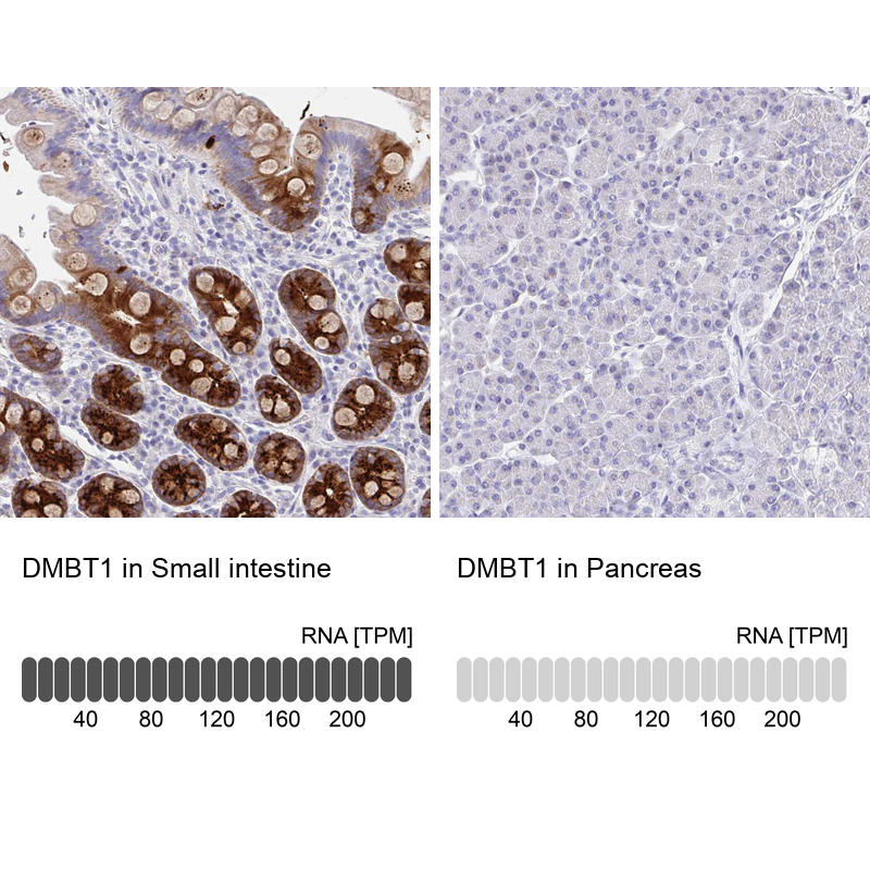 Anti-DMBT1 Antibody