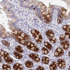 Immunohistochemical staining of human small intestine shows moderate positivity in extracellular matrix in glandular cells.