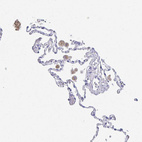 Immunohistochemical staining of human lung shows weak positivity in extracellular matrix in macrophages.