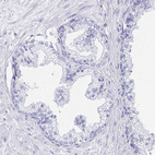 Immunohistochemical staining of human prostate shows no positivity in glandular cells as expected.