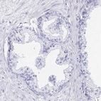 Immunohistochemical staining of human prostate shows no positivity in glandular cells as expected.