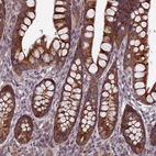 Immunohistochemical staining of human small intestine shows strong cytoplasmic positivity in glandular cells.