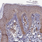 Immunohistochemical staining of human skin shows moderate cytoplasmic positivity in squamous epithelial cells.