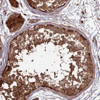 Immunohistochemical staining of human testis shows strong cytoplasmic positivity in cells in seminiferous ducts.