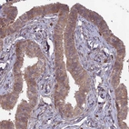 Immunohistochemical staining of human fallopian tube shows moderate cytoplasmic positivity in glandular cells.