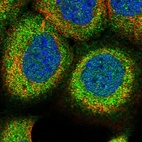 Immunofluorescent staining of human cell line A-431 shows localization to plasma membrane & cytosol.