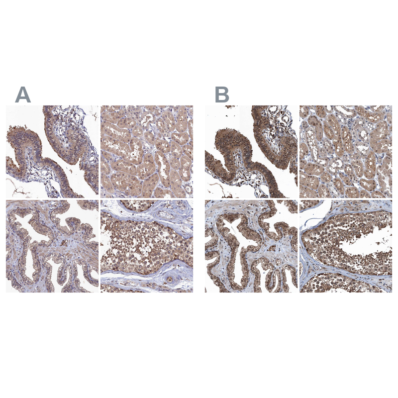 Anti-RNH1 Antibody