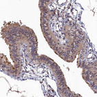 Immunohistochemical staining of human fallopian tube shows moderate cytoplasmic positivity in glandular cells.