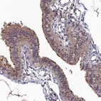 Immunohistochemical staining of human fallopian tube shows moderate cytoplasmic positivity in glandular cells.