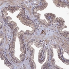 Immunohistochemical staining of human prostate shows moderate cytoplasmic positivity in glandular cells.