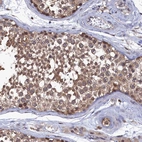 Immunohistochemical staining of human testis shows strong cytoplasmic positivity in cells in seminiferous ducts.