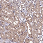 Immunohistochemical staining of human kidney shows moderate cytoplasmic positivity in cells in tubules.