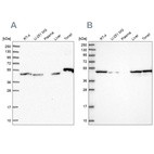 Western blot analysis using Anti-RNH1 antibody HPA040781 (A) shows similar pattern to independent antibody HPA039223 (B).