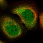 Immunofluorescent staining of human cell line A-431 shows localization to nucleoplasm & cytosol.