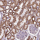 Immunohistochemical staining of human kidney shows strong cytoplasmic granular positivity in cells in tubules.