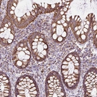Immunohistochemical staining of human rectum shows strong cytoplasmic granular positivity in glandular cells.