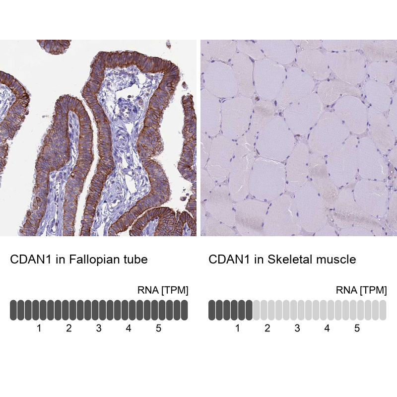 Anti-CDAN1 Antibody