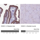 Anti-CDAN1 Antibody