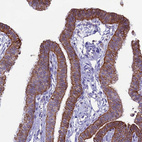 Immunohistochemical staining of human Fallopian tube shows strong membranous positivity in glandular cells.