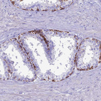 Immunohistochemical staining of human prostate shows strong membranous positivity in glandular cells.