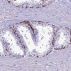 Immunohistochemical staining of human prostate shows strong membranous positivity in glandular cells.