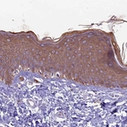 Immunohistochemical staining of human skin shows moderate cytoplasmic positivity in glandular cells.
