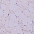 Immunohistochemical staining of human skeletal muscle shows no positivity in myocytes as expected.
