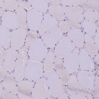 Immunohistochemical staining of human skeletal muscle shows no positivity in myocytes as expected.
