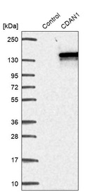 Western blot analysis in control (vector only transfected HEK293T lysate) and CDAN1 over-expression lysate (Co-expressed with a C-terminal myc-DDK tag (~3.1 kDa) in mammalian HEK293T cells, LY408581).