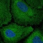 Immunofluorescent staining of human cell line HeLa shows localization to plasma membrane & cytosol.