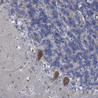 Anti-QPCTL Antibody