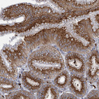 Anti-QPCTL Antibody