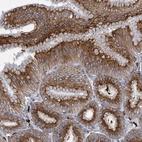 Immunohistochemical staining of human Stomach shows moderate cytoplasmic positivity in glandular cells.