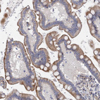 Immunohistochemical staining of human Colon shows moderate cytoplasmic positivity in glandular cells.