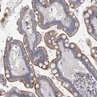 Immunohistochemical staining of human Colon shows moderate cytoplasmic positivity in glandular cells.