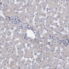 Immunohistochemical staining of human Liver shows very weak cytoplasmic positivity in hepatocytes.