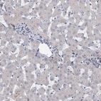 Immunohistochemical staining of human Liver shows very weak cytoplasmic positivity in hepatocytes.