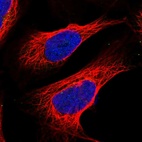 Anti-QPCTL Antibody