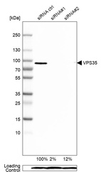 Anti-VPS35 Antibody