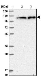 Lane 1: Marker [kDa] 250, 130, 95, 72, 55, 36, 28, 17, 10_br/_Lane 2: Human cell line RT-4_br/_Lane 3: Human cell line U-251MG sp