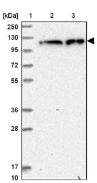 Lane 1: Marker [kDa] 250, 130, 95, 72, 55, 36, 28, 17, 10_br/_Lane 2: Human cell line RT-4_br/_Lane 3: Human cell line U-251MG sp