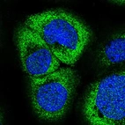 Immunofluorescent staining of human cell line A-431 shows localization to cytosol.